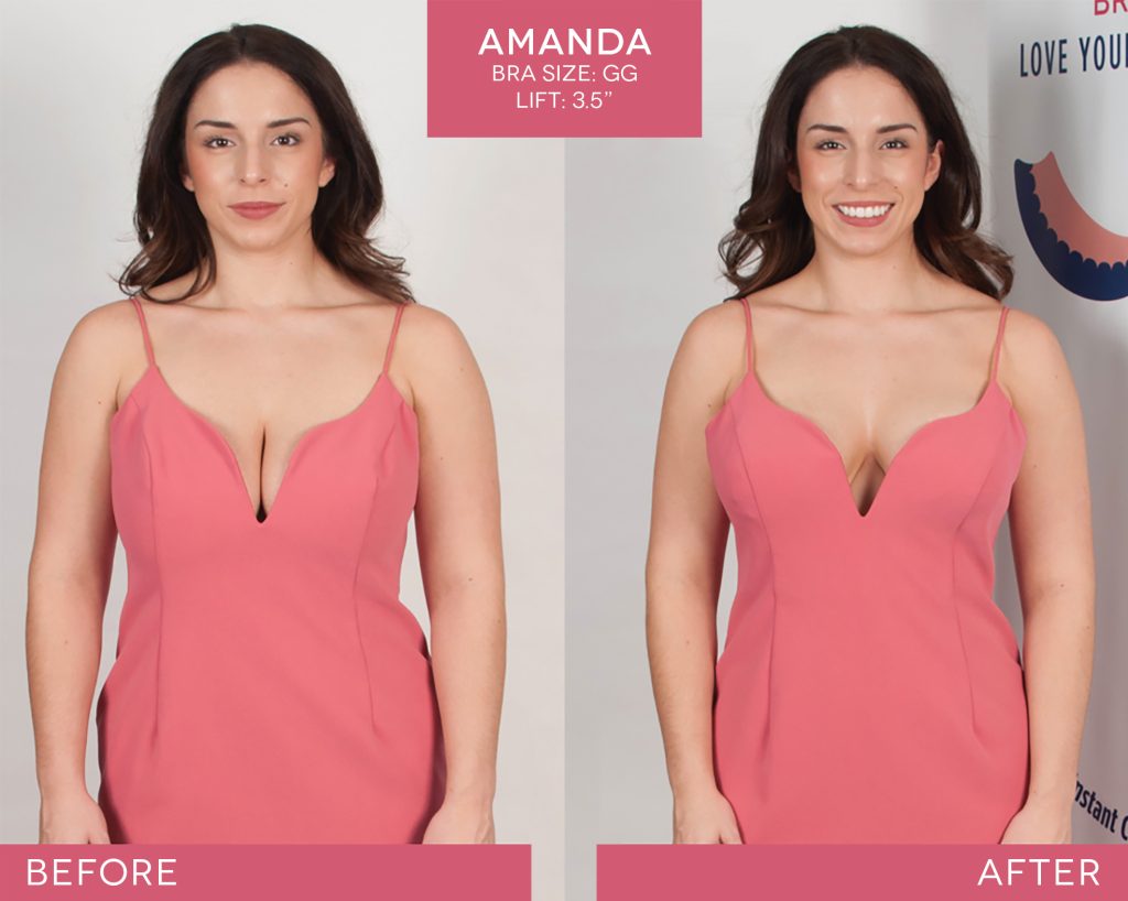 BralessBra-Amanda_Before-After-1