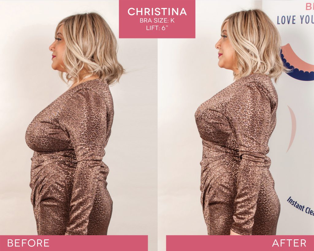 BralessBra-Christina_Before-After-1