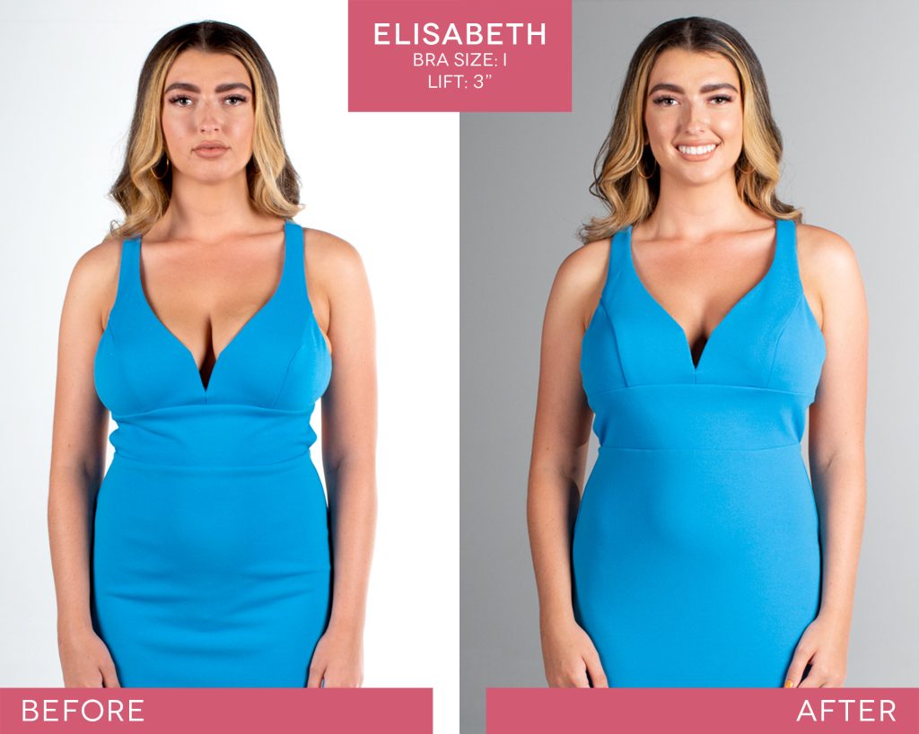 BralessBra-Elisabeth_Before-After-2