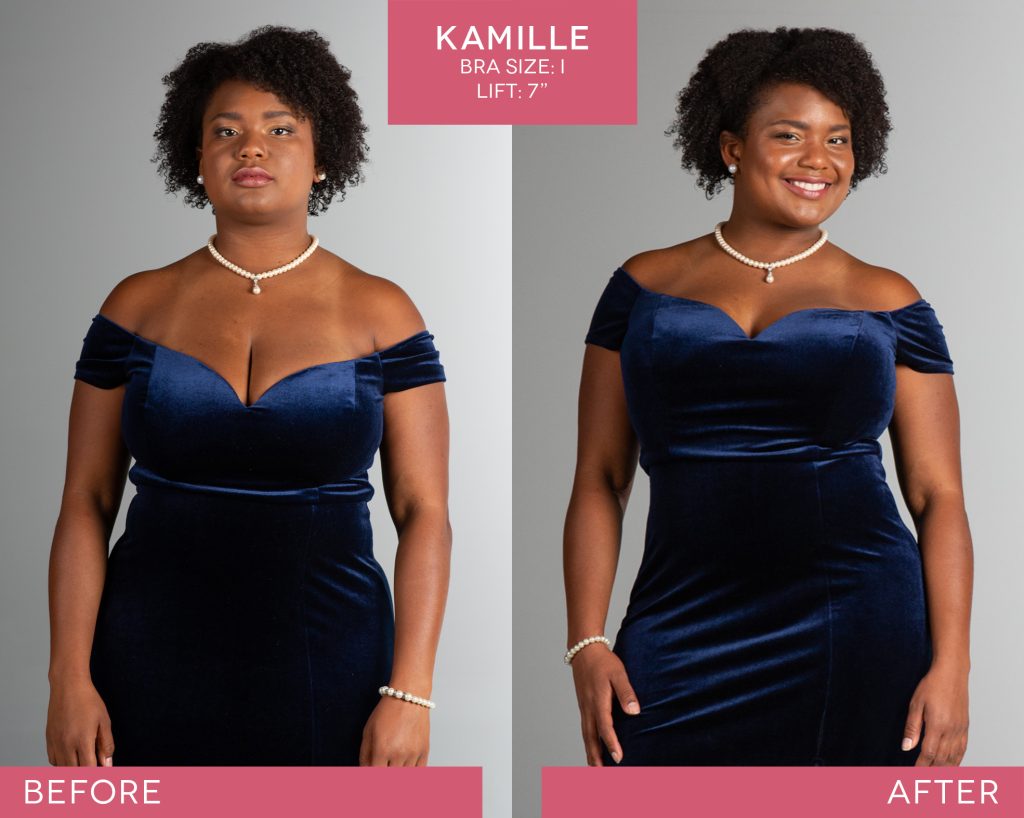 BralessBra-Kamille_Before-After-2