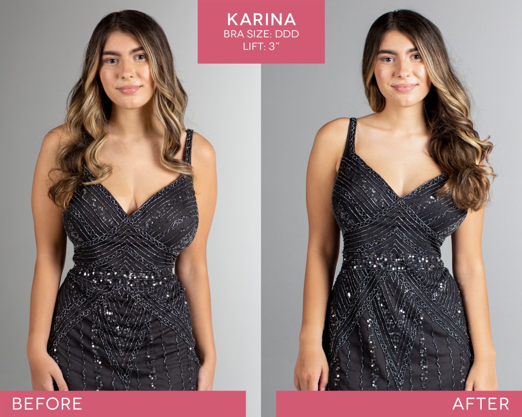 BralessBra-Karina_Before-After-2