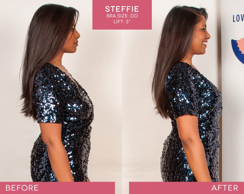 BralessBra-Steffie_Before-After-1