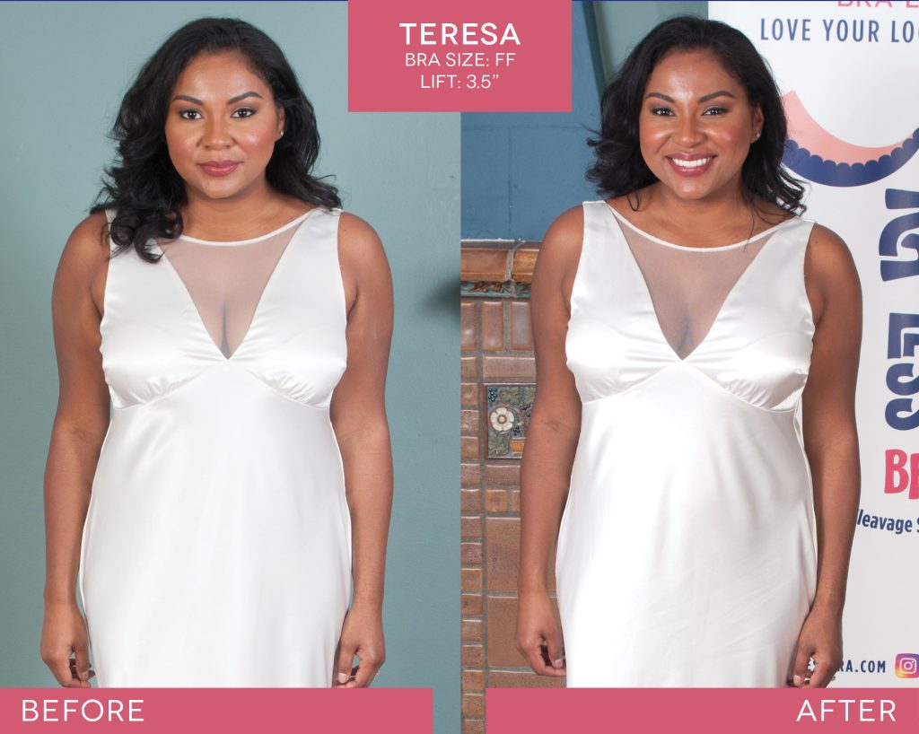 BralessBra-Teresa_Before-After-2