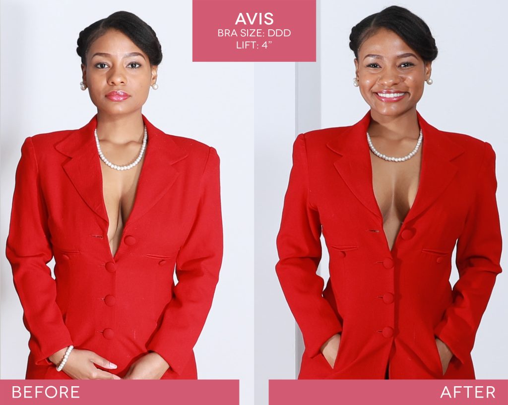 BralessBra-Avis_Before-After-1