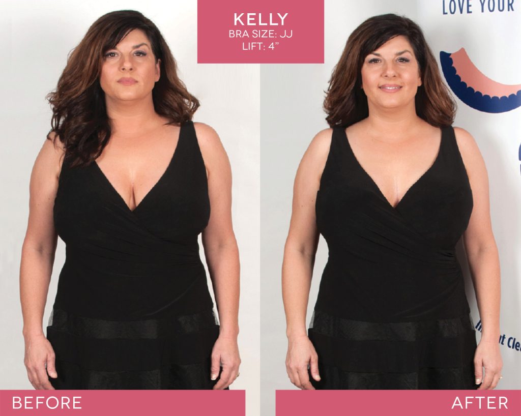 BralessBra-Kelly_Before-After-2